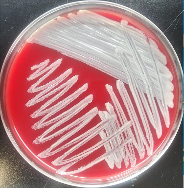 栅栏状革兰阳性杆菌,23号,质谱结果显示该菌仍然为纹带棒状杆菌(分值