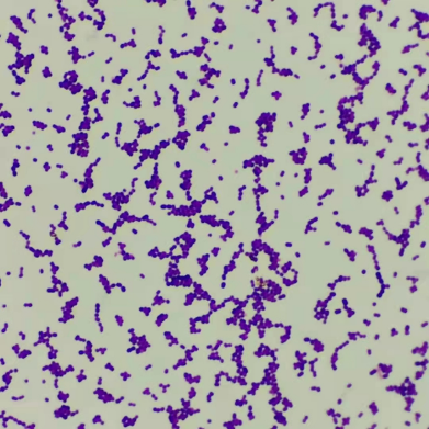 显微镜下的球菌图片