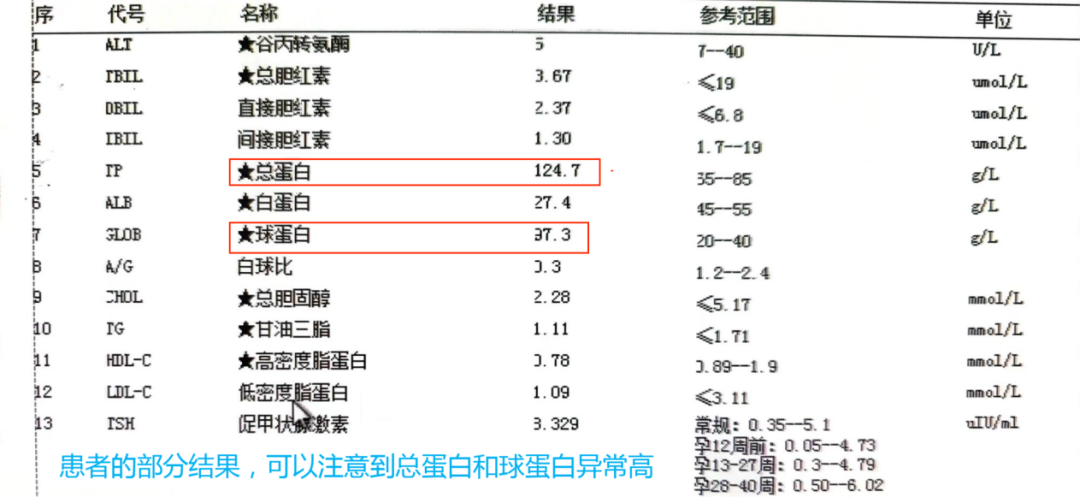 生化设备有哪些问题收藏再看！检验科生化发光流水线的一些『不常见』问题分析_https://www.jmylbn.com_新闻资讯_第4张