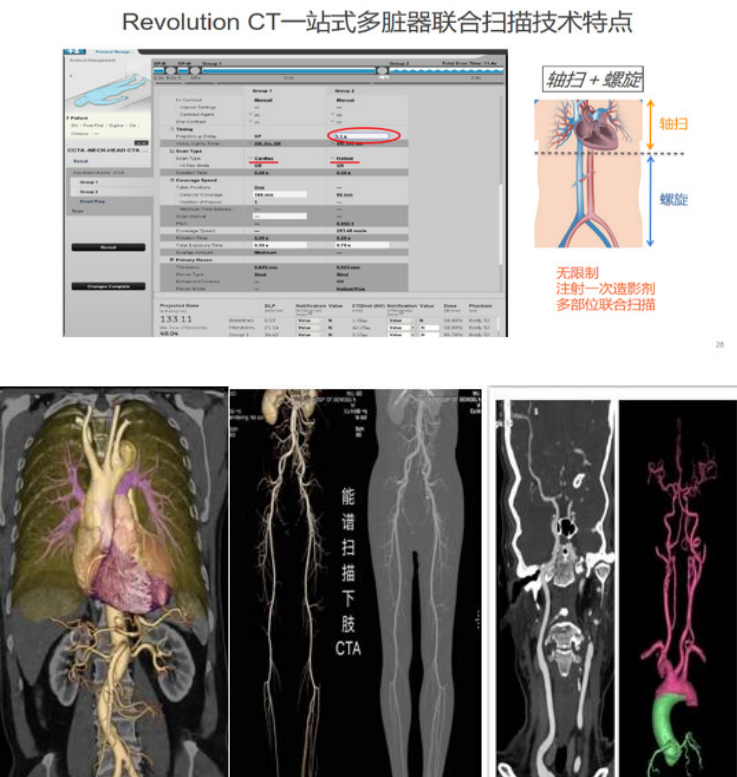 GE病人列表怎么删除​【院之重器】GE Revolution 256排超高端CT：让诊断更快，更精准！_https://www.jmylbn.com_新闻资讯_第5张