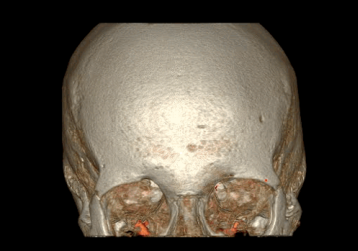 GE病人列表怎么删除​【院之重器】GE Revolution 256排超高端CT：让诊断更快，更精准！_https://www.jmylbn.com_新闻资讯_第2张