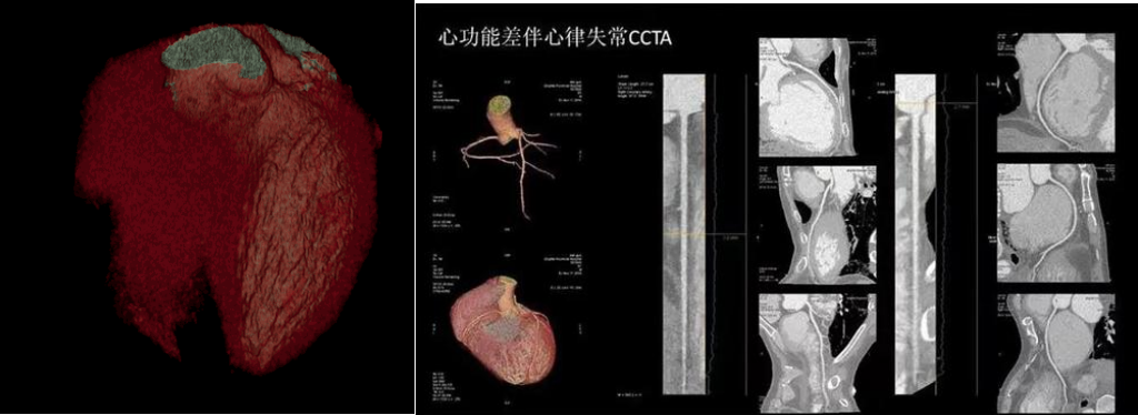 GE病人列表怎么删除​【院之重器】GE Revolution 256排超高端CT：让诊断更快，更精准！_https://www.jmylbn.com_新闻资讯_第4张