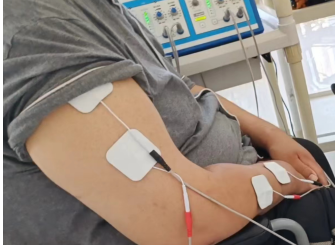 中频为什么能镇痛物理因子疗法——低中频电疗法_https://www.jmylbn.com_新闻资讯_第7张