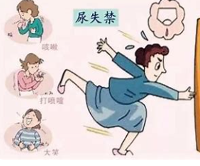尿道张力过强怎么回事女性重度“压力性尿失禁”患者的福音——耻骨后经阴道尿道中段无张力悬吊术_https://www.jmylbn.com_新闻资讯_第3张