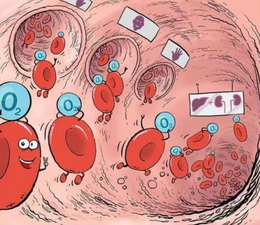 为什么要使用吸氧解密丨手术后为什么要吸氧？专业解答来了_https://www.jmylbn.com_新闻资讯_第6张