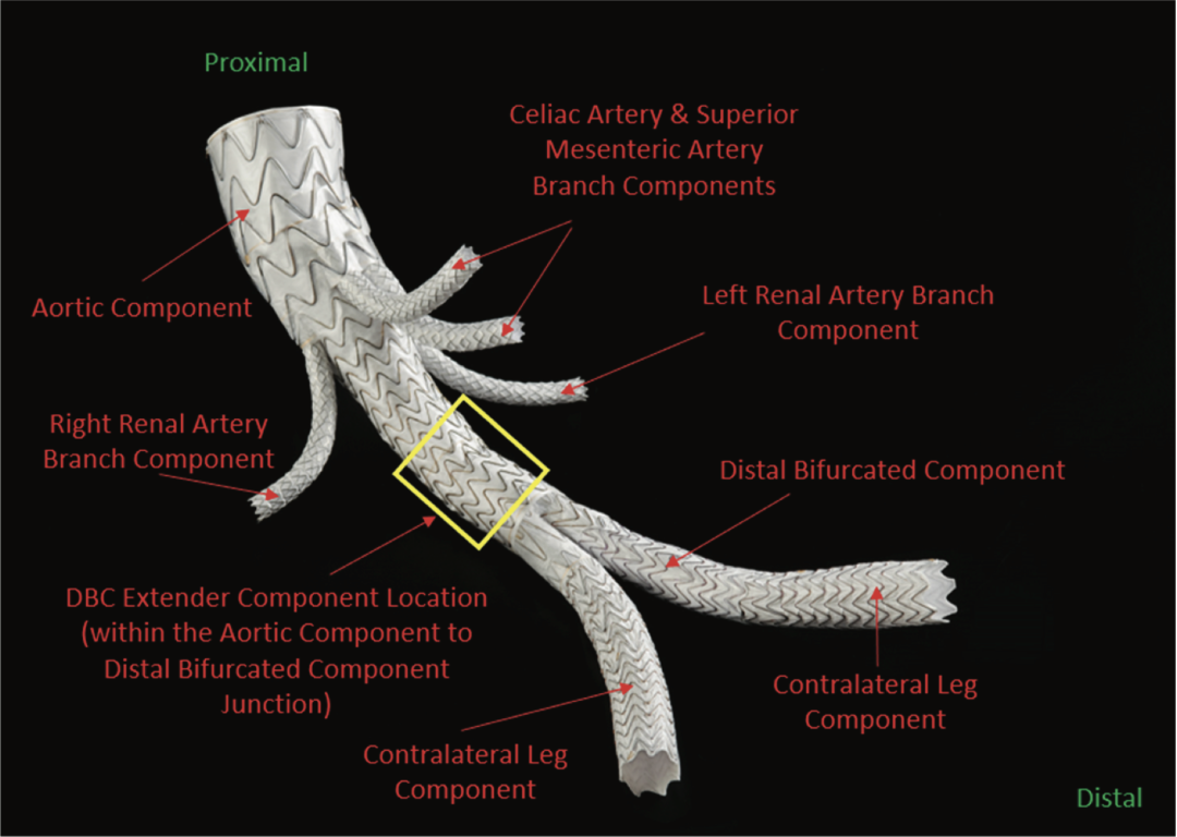 gore医疗怎么样TAMBE重塑复杂主动脉瘤治疗格局的技术解析_https://www.jmylbn.com_新闻资讯_第14张