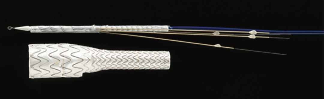 gore医疗怎么样TAMBE重塑复杂主动脉瘤治疗格局的技术解析_https://www.jmylbn.com_新闻资讯_第19张