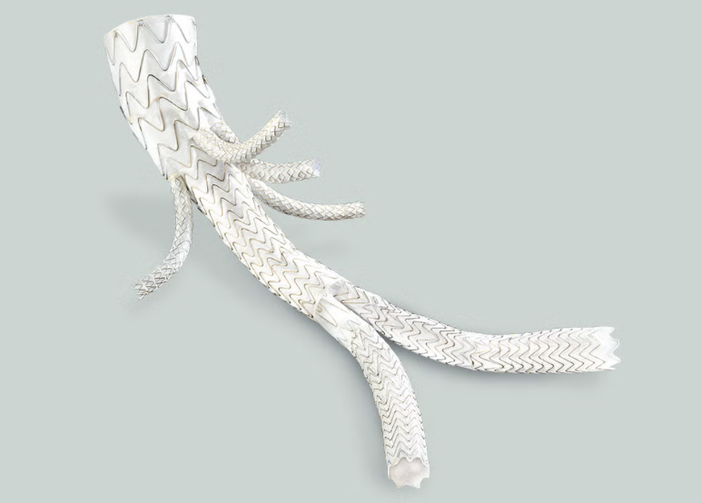 gore医疗怎么样TAMBE重塑复杂主动脉瘤治疗格局的技术解析_https://www.jmylbn.com_新闻资讯_第5张