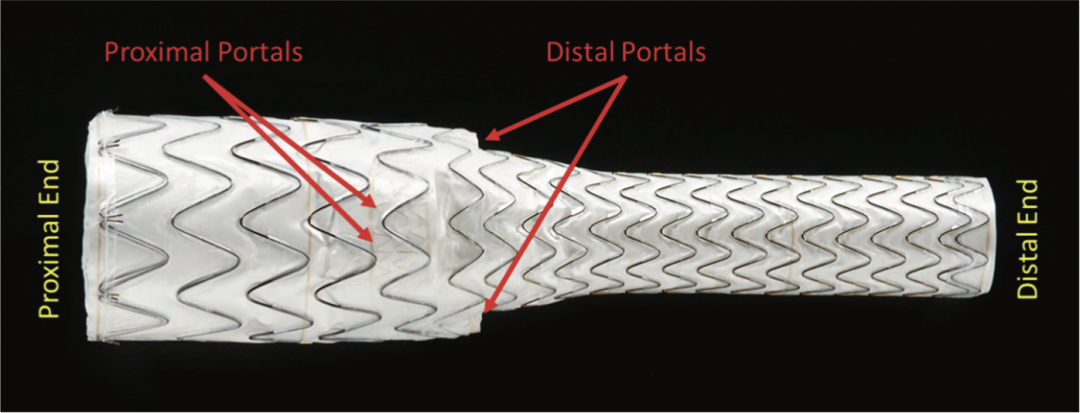 gore医疗怎么样TAMBE重塑复杂主动脉瘤治疗格局的技术解析_https://www.jmylbn.com_新闻资讯_第16张