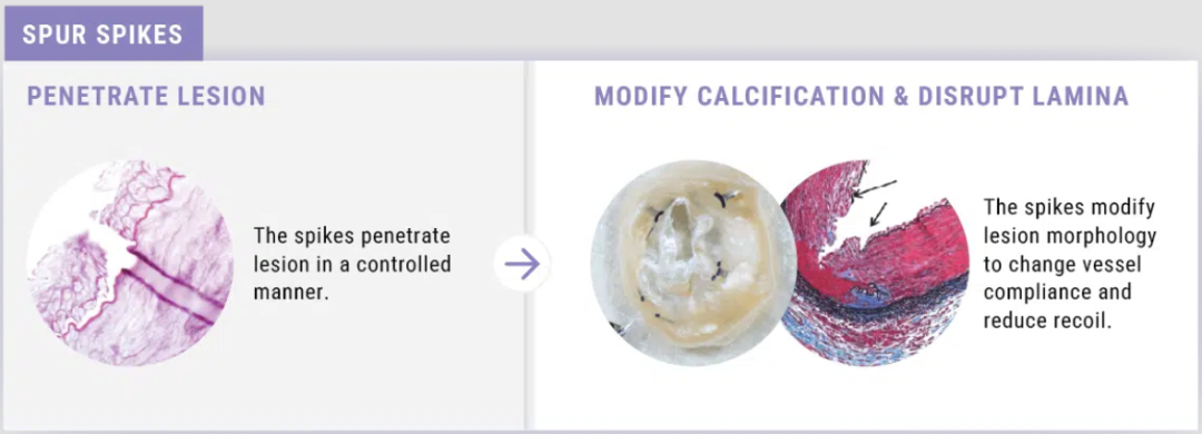 什么是外周支架雁过留声, 但它什么也没留下-外周可回收支架系统_https://www.jmylbn.com_新闻资讯_第18张