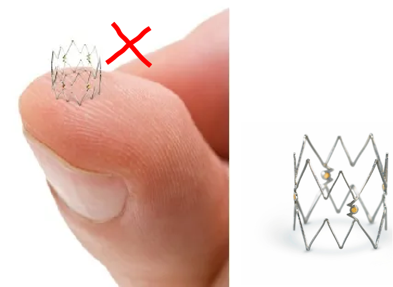 什么是外周支架雁过留声, 但它什么也没留下-外周可回收支架系统_https://www.jmylbn.com_新闻资讯_第31张