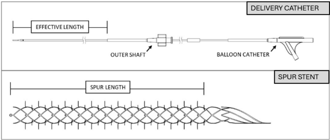 什么是外周支架雁过留声, 但它什么也没留下-外周可回收支架系统_https://www.jmylbn.com_新闻资讯_第9张