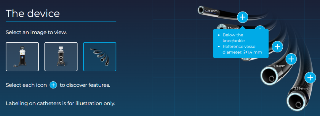 pta在医学上什么意思足背动脉旁路术：从技术革新到精准医疗_https://www.jmylbn.com_新闻资讯_第31张