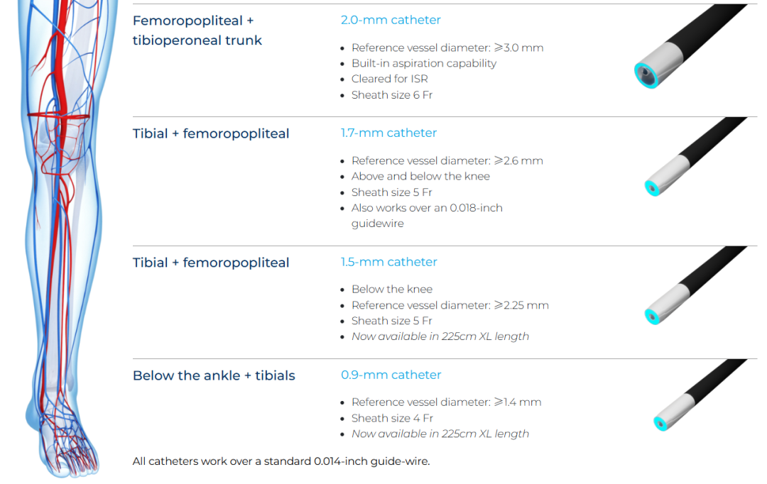 pta在医学上什么意思足背动脉旁路术：从技术革新到精准医疗_https://www.jmylbn.com_新闻资讯_第11张