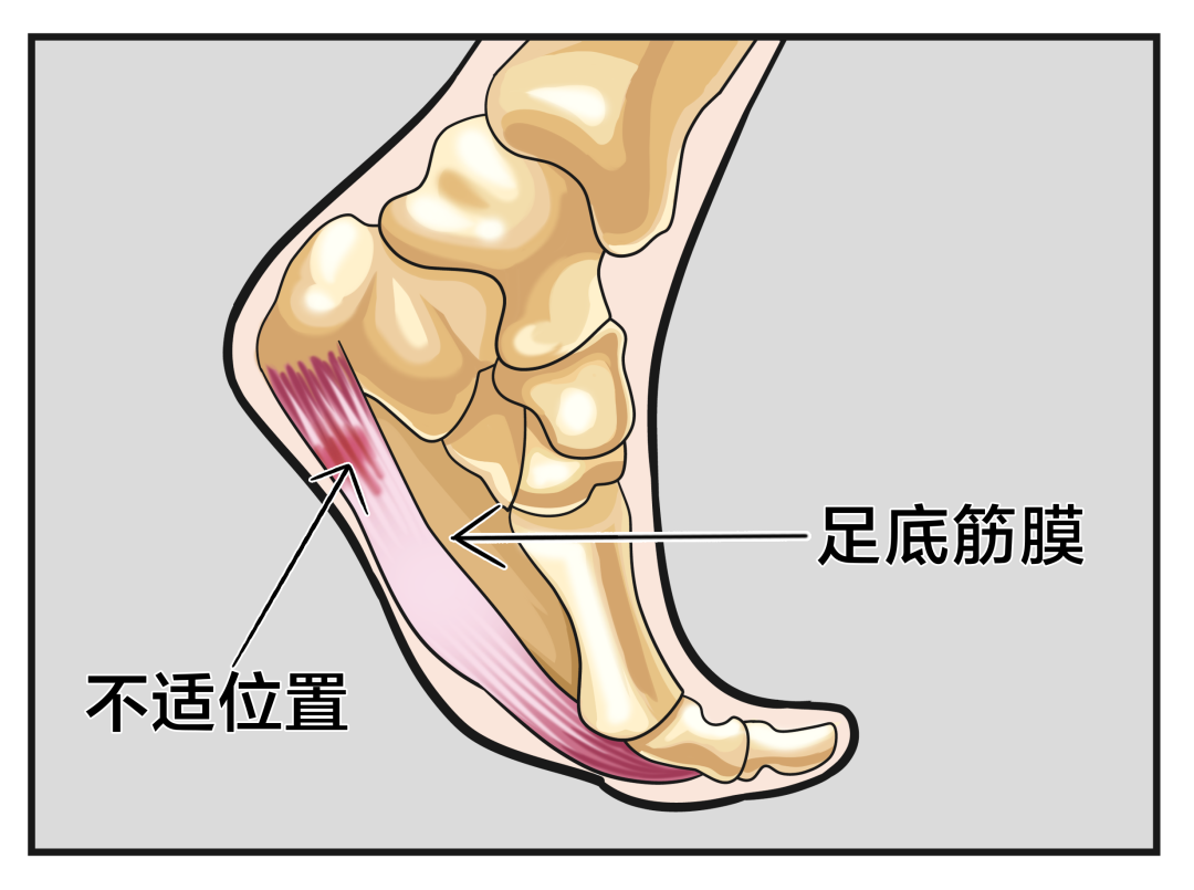 健力多 你问我答 足后跟不适是怎么回事 健力多官方旗舰店