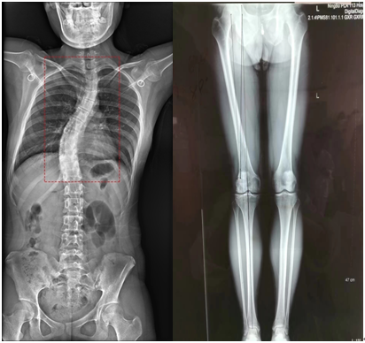 数字化摄影是什么检查【科技兴院】高台县中医医院新引进高端数字化透视摄影X射线机_https://www.jmylbn.com_新闻资讯_第5张