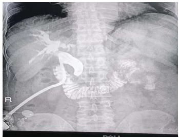 数字化摄影是什么检查【科技兴院】高台县中医医院新引进高端数字化透视摄影X射线机_https://www.jmylbn.com_新闻资讯_第4张