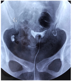 数字化摄影是什么检查【科技兴院】高台县中医医院新引进高端数字化透视摄影X射线机_https://www.jmylbn.com_新闻资讯_第3张