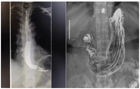 数字化摄影是什么检查【科技兴院】高台县中医医院新引进高端数字化透视摄影X射线机_https://www.jmylbn.com_新闻资讯_第2张