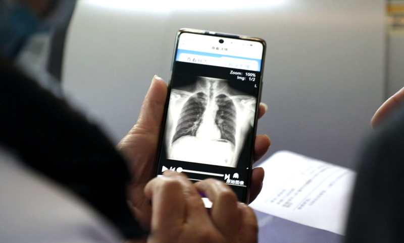 医学胶片怎么做医院看病更快！岳西医学影像进入“云胶片” 新时代_https://www.jmylbn.com_新闻资讯_第2张