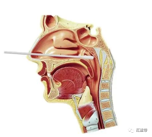核酸咽拭子用于核酸检测的咽拭子收集方法