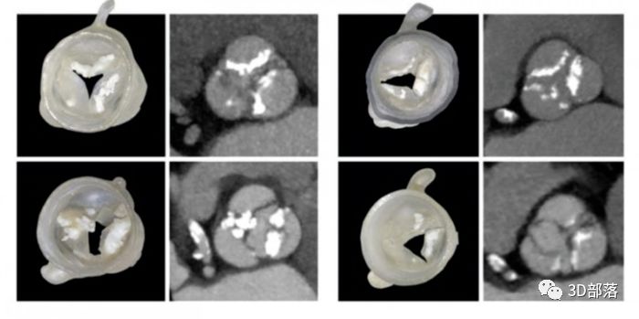 3D列印技術運用到受損心臟領域 千萬患者的福音 科技 第2張