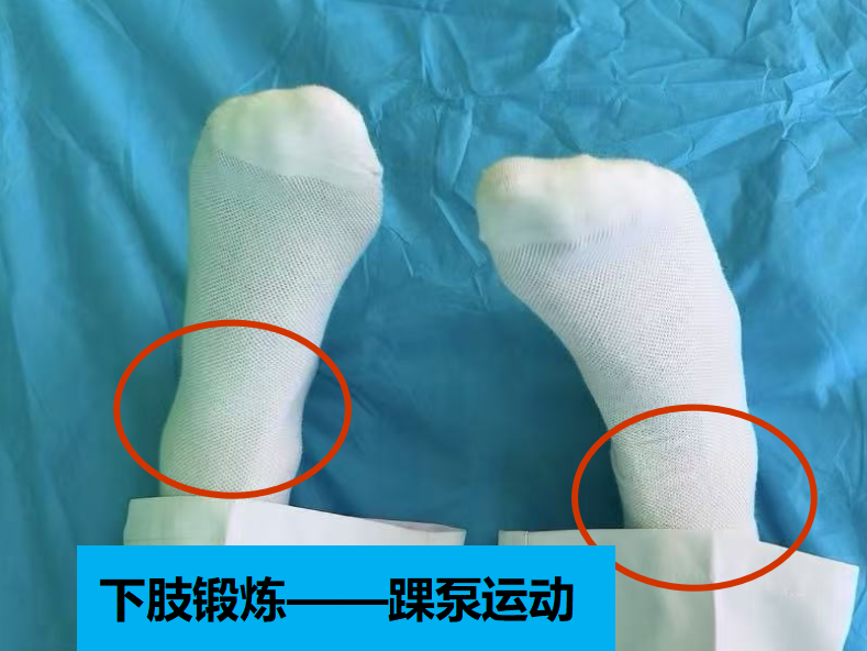 vsd引流器怎么连接【健康科普】创面的“吸尘器”——VSD负压封闭引流知多少？_https://www.jmylbn.com_新闻资讯_第4张