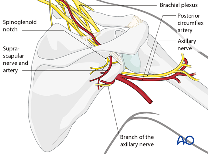 肩胛骨手术标准入路全解析：从解剖到操作的实战指南