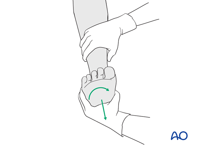 股骨颈骨折全髋关节置换术有哪些细节？看这篇AO指南就够了
