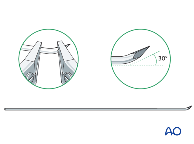 【手术技术】儿童尺桡骨双骨折的弹性髓内钉内固定（AO官网指南）