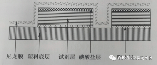 为什么要做尿液分析仪尿常规报告分析_https://www.jmylbn.com_新闻资讯_第2张