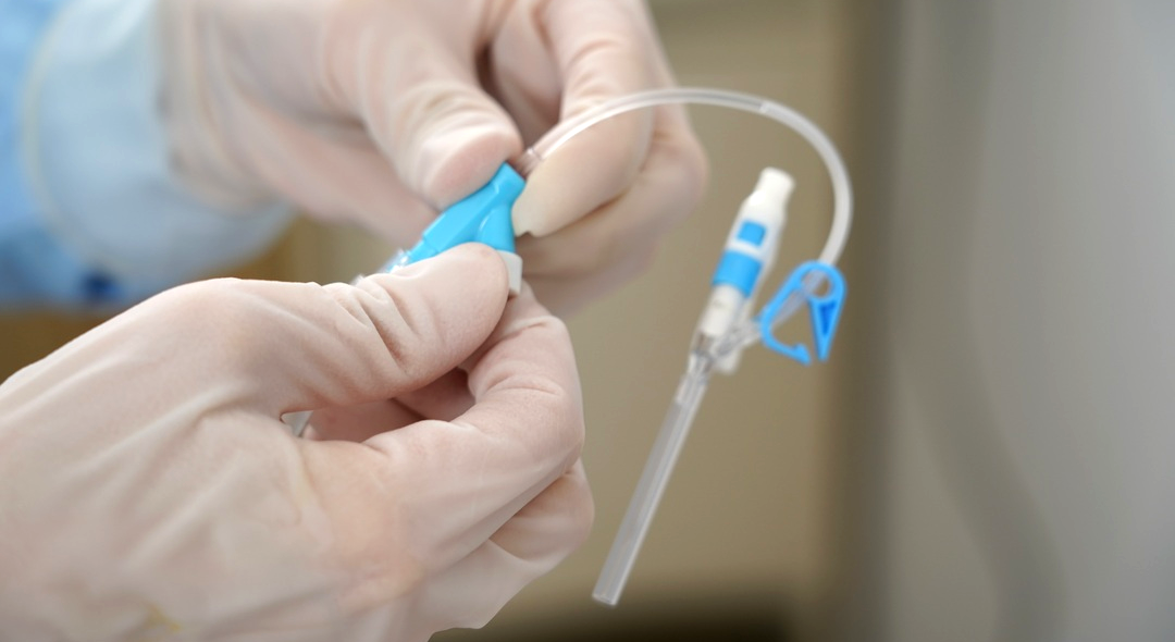 留置针型号g怎么读【静疗圈】留置针可用于干细胞采集吗？发生静脉炎该如何处理？_https://www.jmylbn.com_新闻资讯_第2张