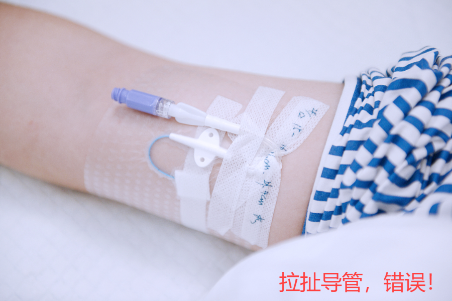 什么是医用导管固定贴通道VLOG｜中长导管和PICC这样固定，安全又牢固！_https://www.jmylbn.com_新闻资讯_第6张