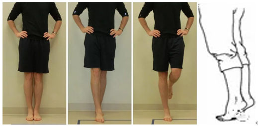 医用充气靴怎么穿踝关节外侧韧带修复术后康复小科普_https://www.jmylbn.com_新闻资讯_第8张