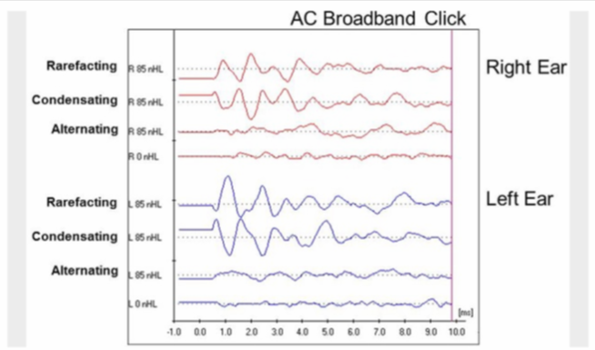 听力AC为什么0临床听力学技术专业沙龙 ｜ 傅新星：AEP临床应用和新进展_https://www.jmylbn.com_新闻资讯_第22张