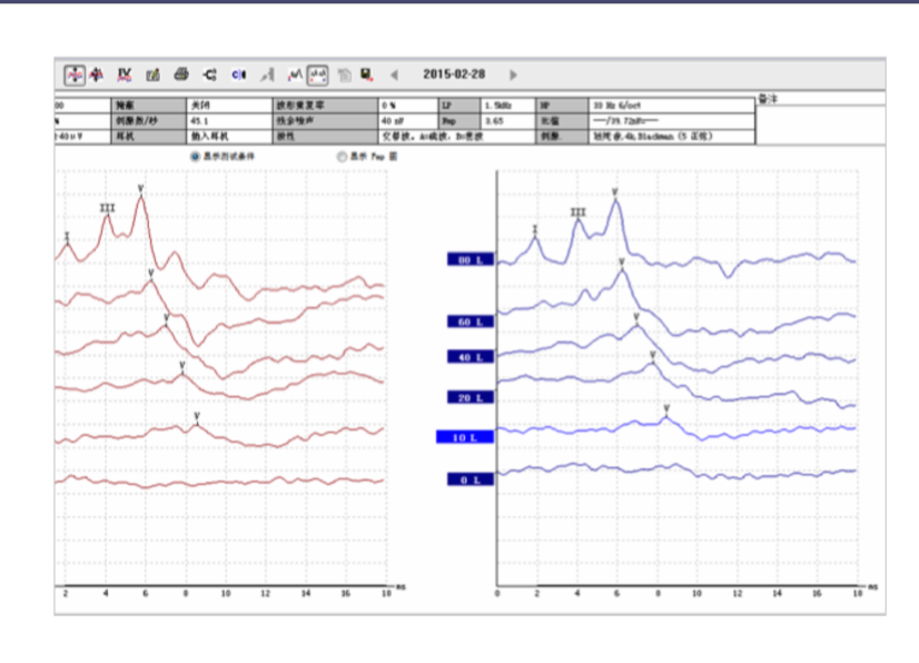 听力AC为什么0临床听力学技术专业沙龙 ｜ 傅新星：AEP临床应用和新进展_https://www.jmylbn.com_新闻资讯_第21张