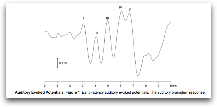 听力AC为什么0临床听力学技术专业沙龙 ｜ 傅新星：AEP临床应用和新进展_https://www.jmylbn.com_新闻资讯_第8张