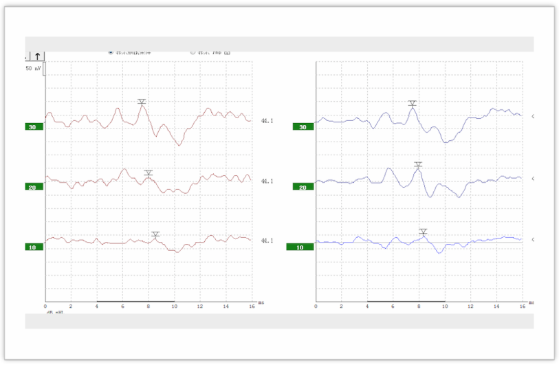 听力AC为什么0临床听力学技术专业沙龙 ｜ 傅新星：AEP临床应用和新进展_https://www.jmylbn.com_新闻资讯_第16张