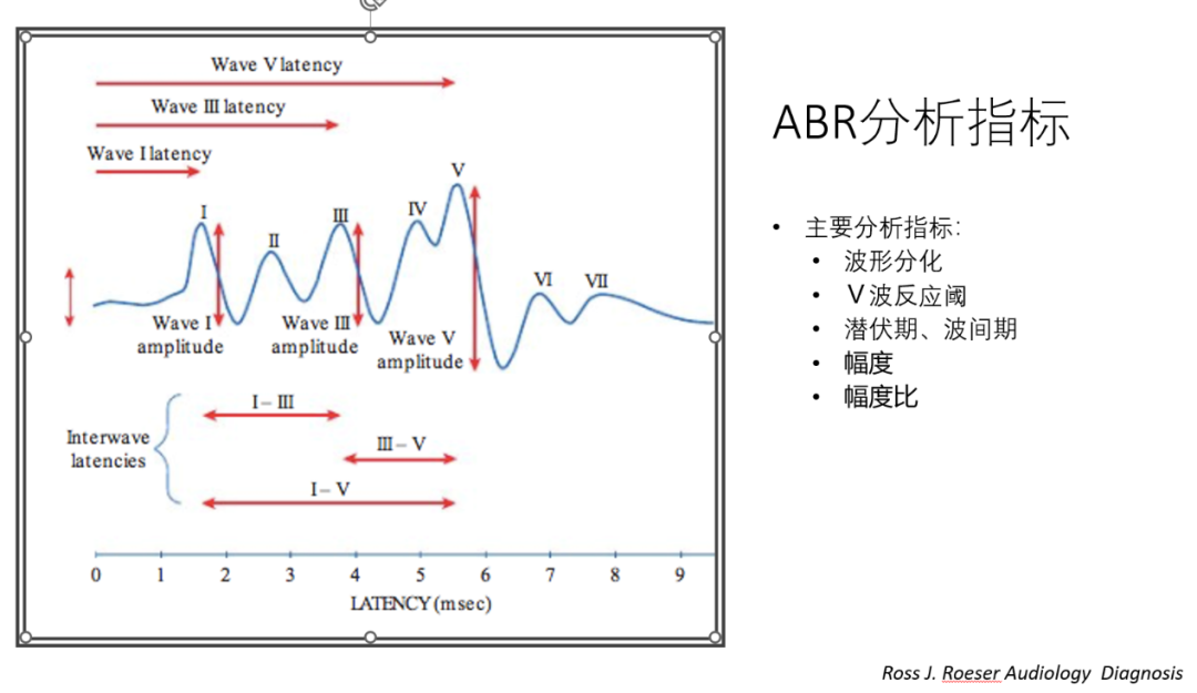 听力AC为什么0临床听力学技术专业沙龙 ｜ 傅新星：AEP临床应用和新进展_https://www.jmylbn.com_新闻资讯_第10张