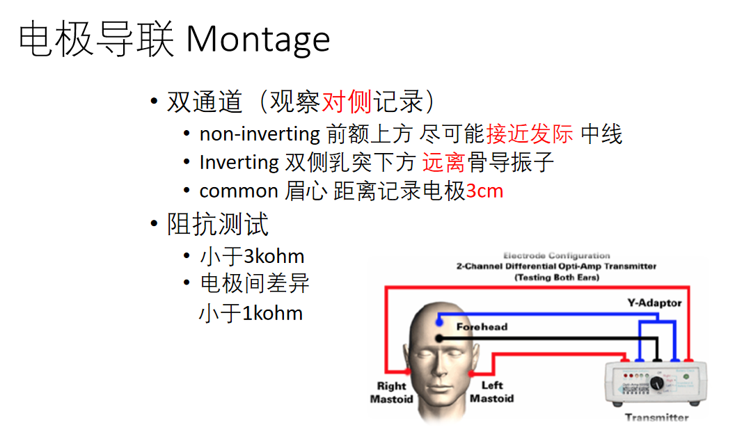 听力AC为什么0临床听力学技术专业沙龙 ｜ 傅新星：AEP临床应用和新进展_https://www.jmylbn.com_新闻资讯_第13张