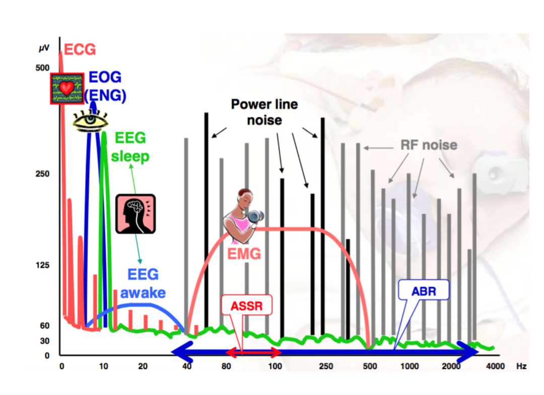 听力AC为什么0临床听力学技术专业沙龙 ｜ 傅新星：AEP临床应用和新进展_https://www.jmylbn.com_新闻资讯_第6张