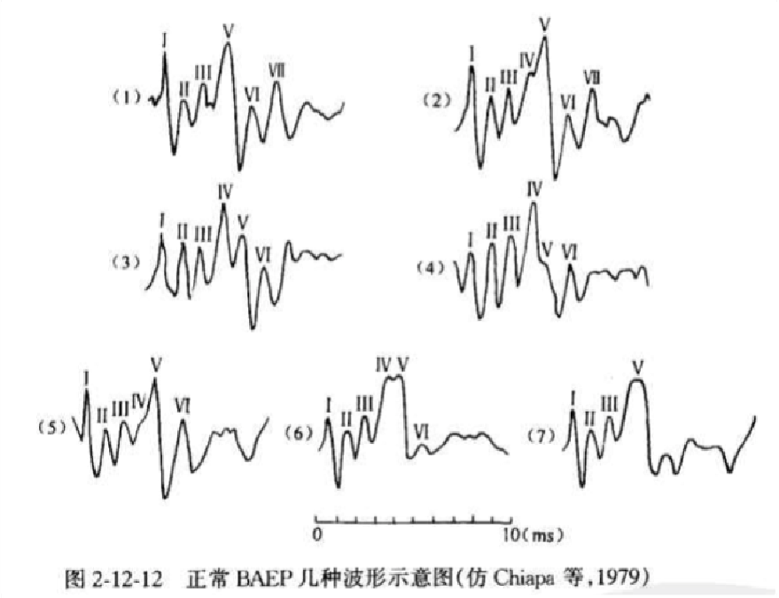 听力AC为什么0临床听力学技术专业沙龙 ｜ 傅新星：AEP临床应用和新进展_https://www.jmylbn.com_新闻资讯_第11张