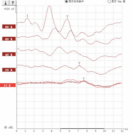 听力AC为什么0临床听力学技术专业沙龙 ｜ 傅新星：AEP临床应用和新进展_https://www.jmylbn.com_新闻资讯_第7张