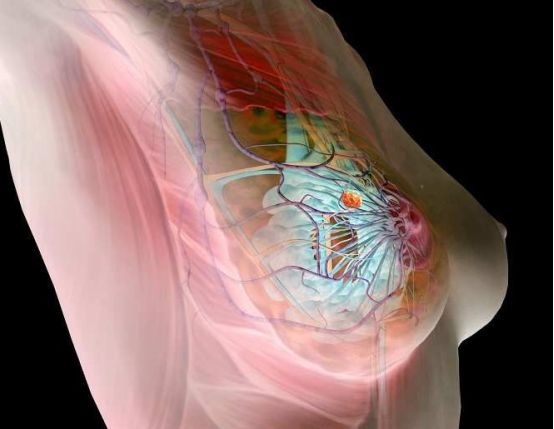 乳房的：发育--异常--发育表现--临床（结节，增生，肿瘤等