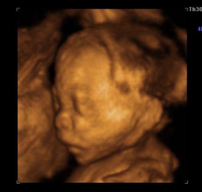 胎儿超声心电图是什么科室风采｜超声、心电图业务概况_https://www.jmylbn.com_新闻资讯_第5张