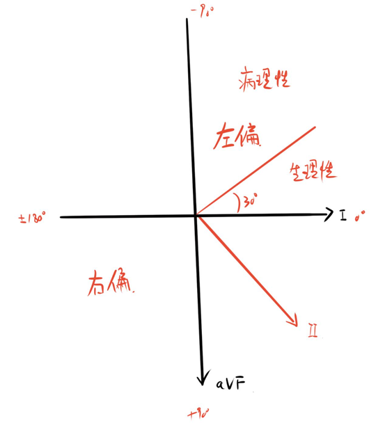 心电图怎么切换导联心电图基础思维方法论，看完的都收藏了_https://www.jmylbn.com_新闻资讯_第7张