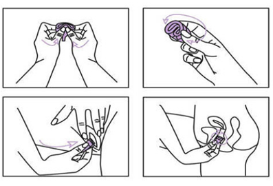 月经杯使用步骤/图源搜狗希望这篇文章能够帮到郑州的姐妹们.