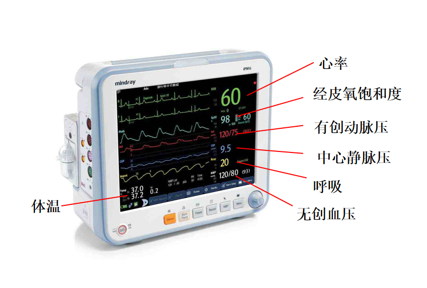 床旁监护仪怎么看ICU坚强卫士---床旁监护仪_https://www.jmylbn.com_新闻资讯_第5张