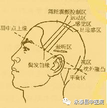 什么是电针仪【中医特色09】针刺类技术——电针技术_https://www.jmylbn.com_新闻资讯_第3张