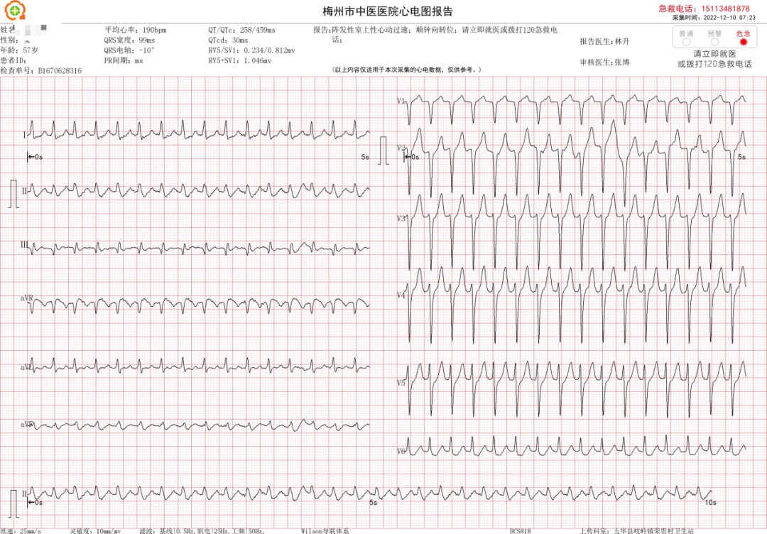 床旁心电图怎么做心电一张网·心电诊断中心｜半夜心慌人难受，乡医床旁显神技——五华县岐岭镇荣贵村卫生站确诊一名室上速患者_https://www.jmylbn.com_新闻资讯_第4张